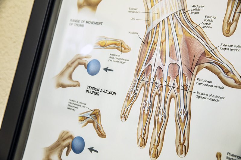 Hand Wrist Treatment Care in OKC | Gunderson Orthopedic